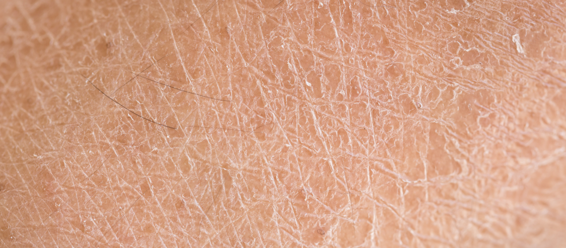 Efectos en la piel por la contaminación